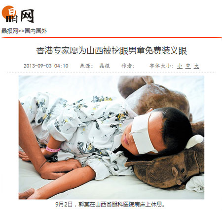 山西被挖眼男童免費(fèi)裝義眼