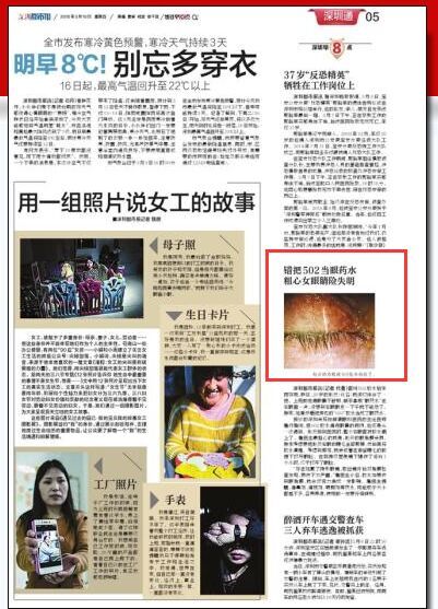 【深圳都市報】錯把502當(dāng)眼藥水 粗心女眼睛險失明